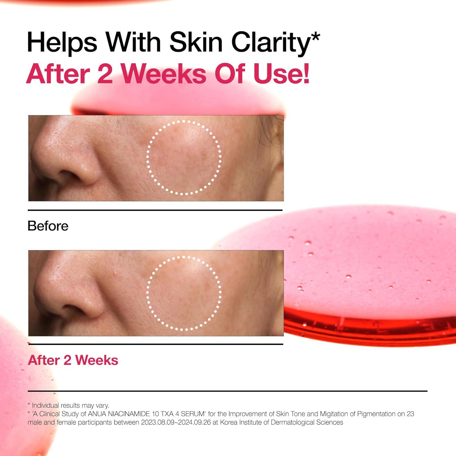 ANUA Niacinamide 10% + TXA 4% Dark Spot Correcting Serum (30ml)