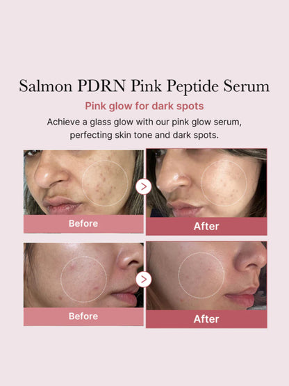 MEDICUBE PDRN Pink Peptide Glow Serum (30ml)